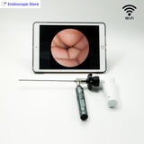 HD Handheld Portable ENT Examination Surgery Endoscope WIFI Wireless Camera 1080P With LED Light Source Rechargeable