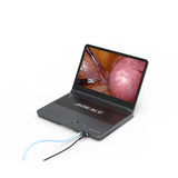 HD Mobile Intergrated 1080P Endoscope Camera System With LED Light Source With 17 inch Monitor ENT Examination