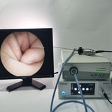 HD 720P Medical Endoscope Video Camera System E.N.T. Examination