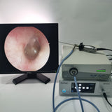 HD 720P Medical Endoscope Video Camera System E.N.T. Examination