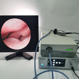 HD 720P Medical Endoscope Video Camera System E.N.T. Examination